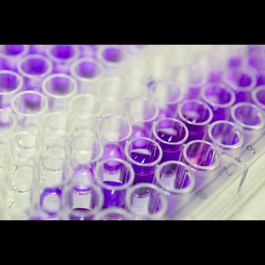 ELISA Kit for Alphasize:Fetoprotein  AFP , 96 test